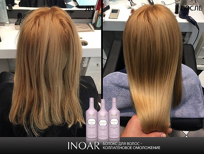 кэрол маджио 2022. косметология мезотерапия. женщина с морщинами. волосы омоложение. волосы омоложение.